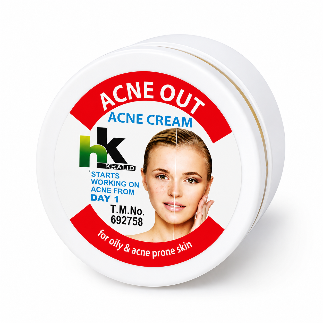 HK Khalid Acne Out | Acne Cream